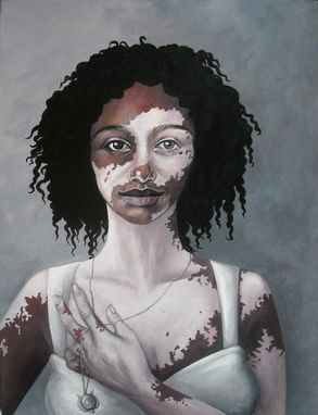 Custom Made Renewal-Acrylic On Canvas Portrait Of A Woman With Vitiligo